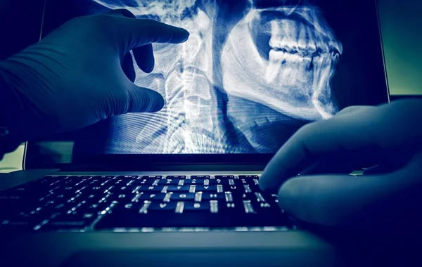 Digital X Ray