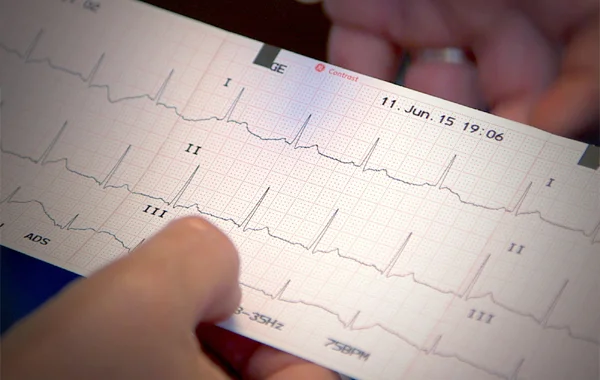 Computerized ECG